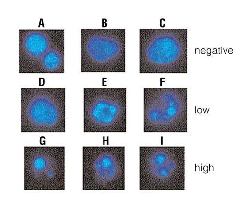Fluorescence microscopy of anti-Fas IgM-treated and CaspACE FITC-VAD-FMK In Situ Marker labeled cells.