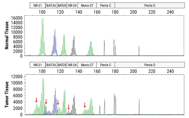 Representative microsatellite instability data.